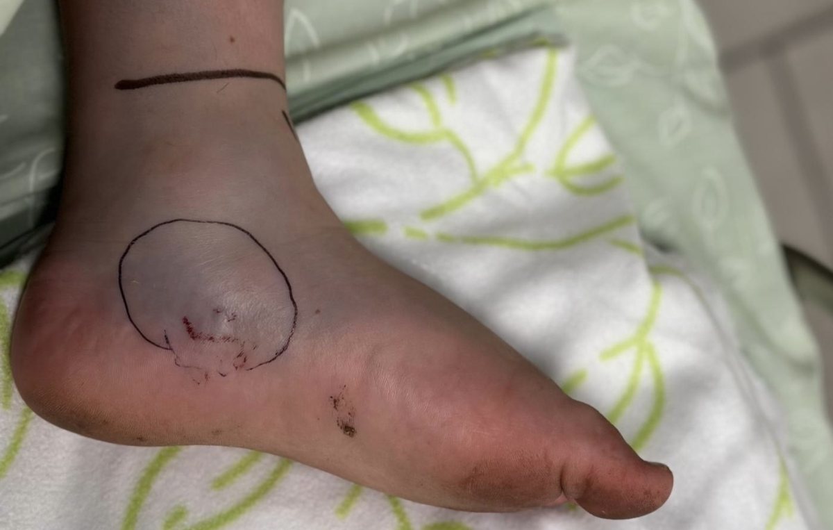 צילום: בית החולים אסותא אשדוד